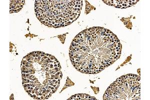ABIN7096269 and ABIN7100331 at 1/100 staining mouse testis tissue by IHC-P. (SHCBP1L 抗体)