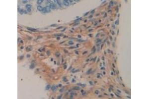 Used in DAB staining on fromalin fixed paraffin- embedded skeletal muscle tissue (Myopalladin 抗体  (AA 945-1320))