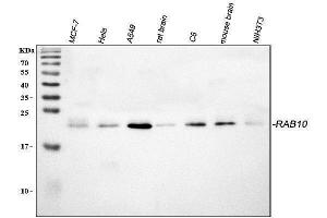 Western blot analysis of RAB10 using anti-RAB10 antibody (ABIN3043448).
