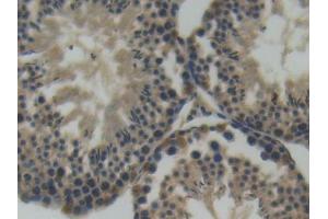 IHC-P analysis of Mouse Testis Tissue, with DAB staining. (SEMA4D/CD100 抗体  (AA 502-636))