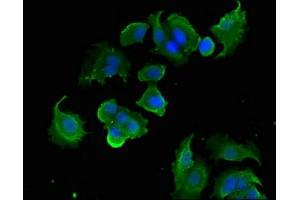 Immunofluorescent analysis of MCF-7 cells using ABIN7166448 at dilution of 1:100 and Alexa Fluor 488-congugated AffiniPure Goat Anti-Rabbit IgG(H+L) (PTK6 抗体  (AA 1-113))