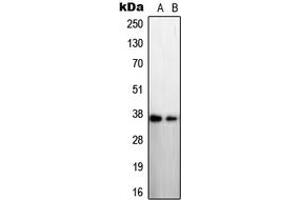 Western blot analysis of STEAP1 expression in LNCaP (A), A431 (B) whole cell lysates. (STEAP1 抗体  (N-Term))