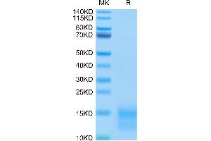 SDS-PAGE (SDS) image for Tumor Necrosis Factor Receptor Superfamily, Member 17 (TNFRSF17) (AA 1-49) protein (His-Avi Tag) (ABIN7273944)