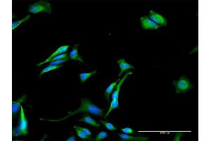 Immunofluorescence of purified MaxPab antibody to GNPAT on HeLa cell. (GNPAT 抗体  (AA 1-680))