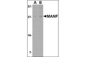 Western blot analysis of MANF in rat brain tissue lysate with this product at (A) 1 and (B) 2 μg/ml. (MANF 抗体  (N-Term))
