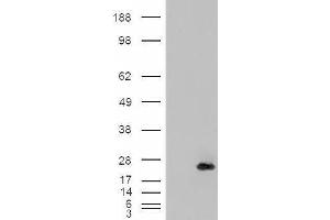 HEK293 overexpressing CRP2 (ABIN5397240) and probed with ABIN238612 (mock transfection in first lane). (CSRP2 抗体  (Internal Region))