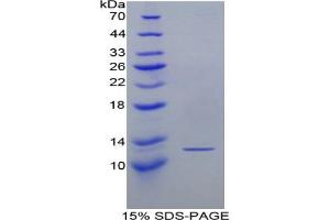 SDS-PAGE analysis of Mouse Lymphotactin Protein. (XCL1 蛋白)