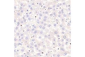 Immunohistochemistry analysis of paraffin-embedded rat hepatitis using,Tal1 (ABIN7075819) at dilution of 1: 1500 (TAL1 抗体)