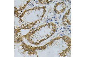 Immunohistochemistry of paraffin-embedded human stomach using SIGMAR1 antibody. (SIGMAR1 抗体)