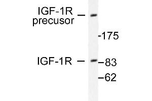 Image no. 1 for anti-Insulin-Like Growth Factor 1 Receptor (IGF1R) antibody (ABIN265476) (IGF1R 抗体)