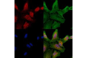 ABIN6257697 and ABIN6274266 staining  cells by IF/ICC.