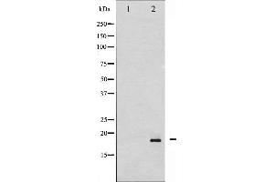 Western Blotting (WB) image for anti-Synuclein, alpha (SNCA) (pSer129) antibody (ABIN6254965)