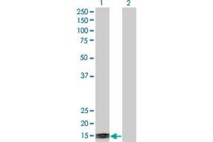 Western Blot analysis of TFF1 expression in transfected 293T cell line by TFF1 monoclonal antibody (M04), clone M2. (TFF1 抗体  (AA 1-84))