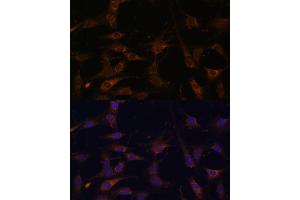 Immunofluorescence analysis of C6 cells using R antibody (ABIN6128592, ABIN6146556, ABIN6146557 and ABIN6215667) at dilution of 1:100. (RAB21 抗体  (AA 1-225))
