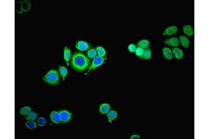 Immunofluorescence (IF) image for anti-TROVE Domain Family, Member 2 (TROVE2) (AA 3-535) antibody (ABIN7142715)
