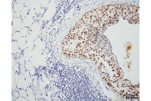 Immunohistochemistry analysis using Rat Anti-HSF1 Monoclonal Antibody, Clone 4B4 . (HSF1 抗体  (AA 425-439) (HRP))