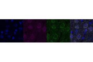 Immunohistochemistry (IHC) image for anti-Ubiquitin Carboxyl-terminal Esterase L1 (Ubiquitin Thiolesterase) (UCHL1) antibody (ABIN7456137) (UCHL1 抗体)