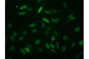Image no. 4 for anti-Chromosome 2 Open Reading Frame 40 (C2orf40) antibody (ABIN1497047) (C2orf40 抗体)