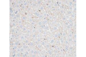 Immunohistochemistry of paraffin-embedded Rat liver using N-Cadherin Polyclonal Antibody at dilution of 1:100 (40x lens). (N-Cadherin 抗体)