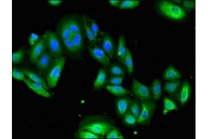 Immunofluorescent analysis of HepG2 cells using ABIN7174352 at dilution of 1:100 and Alexa Fluor 488-congugated AffiniPure Goat Anti-Rabbit IgG(H+L) (USP6 抗体  (C-Term))