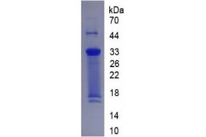 SDS-PAGE (SDS) image for Collagen, Type X (COL10) ELISA Kit (ABIN6574302)