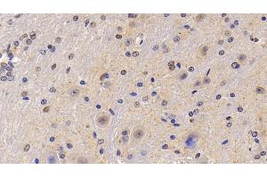 Immunohistochemistry (IHC) image for anti-Sema Domain, Seven Thrombospondin Repeats (Type 1 and Type 1-Like), Transmembrane Domain (TM) and Short Cytoplasmic Domain, (Semaphorin) 5B (SEMA5B) (AA 836-1013) antibody (ABIN7437377)