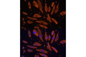 Immunofluorescence analysis of H9C2 cells using CD172a/SIRPα Rabbit pAb (ABIN6130058, ABIN6147780, ABIN6147781 and ABIN6224854) at dilution of 1:100 (40x lens). (SIRPA 抗体  (AA 395-504))