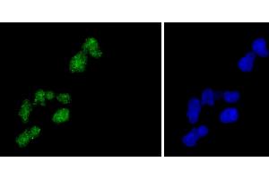 HeLa cells were fixed in paraformaldehyde, permeabilized with 0. (H2AFZ 抗体)