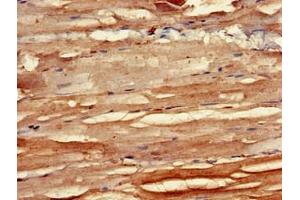 Immunohistochemistry of paraffin-embedded human skeletal muscle tissue using ABIN7145708 at dilution of 1:100 (BMPR1B 抗体  (AA 14-126))
