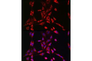 Immunofluorescence analysis of NIH/3T3 cells using PIK3R4/VPS15 Rabbit pAb (ABIN7269323) at dilution of 1:50 (40x lens). (PIK3R4 抗体  (AA 1-330))