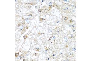Immunohistochemistry (IHC) image for anti-Ras-Related C3 Botulinum Toxin Substrate 2 (Rho Family, Small GTP Binding Protein Rac2) (RAC2) (AA 1-192) antibody (ABIN3021524)