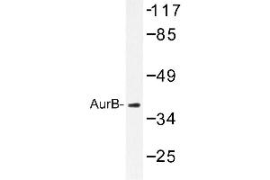 Image no. 1 for anti-Aurora Kinase B (AURKB) antibody (ABIN272096) (Aurora Kinase B 抗体)