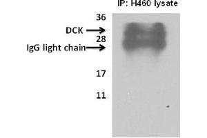 Deoxycytidine kinase(DCK) immunoprecipitated from H460cells with 7. (DCK 抗体  (C-Term))