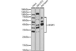 Western blot analysis of extracts of various cell lines, using BNIP3 antibody (ABIN6127502, ABIN6137620, ABIN6137621 and ABIN6221337) at 1:1000 dilution. (BNIP3 抗体  (AA 1-164))