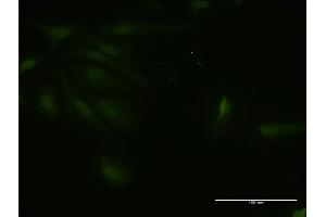 Immunofluorescence of monoclonal antibody to RNF125 on HeLa cell. (RNF125 抗体  (AA 143-231))