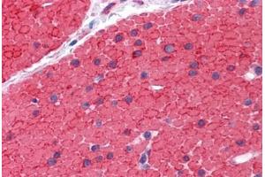 Immunohistochemistry (Formalin-fixed Paraffin-embedded Sections) (IHC (fp)) image for anti-Low Density Lipoprotein Receptor Adaptor Protein 1 (LDLRAP1) (AA 1-264) antibody (ABIN574448)