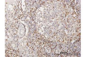 Immunoperoxidase of purified MaxPab antibody to CD2 on formalin-fixed paraffin-embedded human lymph node. (CD2 抗体  (AA 1-351))