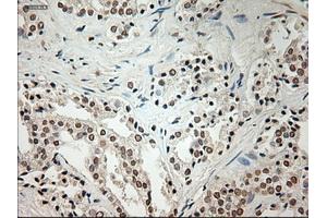 Immunohistochemical staining of paraffin-embedded Ovary tissue using anti-L1CAMmouse monoclonal antibody. (L1CAM 抗体)
