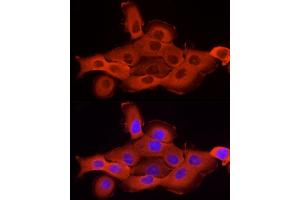 Immunofluorescence (IF) image for anti-Cortactin (CTTN) (AA 214-513) antibody (ABIN6139243)