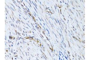 Immunohistochemistry (Paraffin-embedded Sections) (IHC (p)) image for anti-Selectin E (SELE) (AA 22-230) antibody (ABIN3023172)