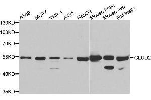 Western blot analysis of extracts of various cell lines, using GLUD2 antibody. (GLUD2 抗体)
