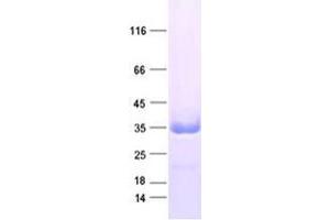 Validation with Western Blot (ZFAND5 Protein (DYKDDDDK Tag))