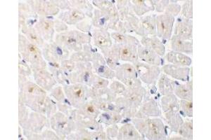 Immunohistochemical staining of DcR3 in human heart tissue with DcR3 antibody at 1μg/ml. (TNFRSF6B 抗体)