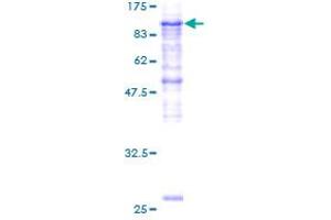Image no. 1 for Procollagen-Lysine 2-Oxoglutarate 5-Dioxygenase 2 (PLOD2) (AA 27-758) protein (GST tag) (ABIN1315449)