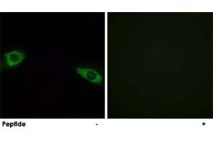 Immunofluorescence analysis of HUVEC cells, using RPS4Y1 polyclonal antibody . (RPS4Y1 抗体  (C-Term))