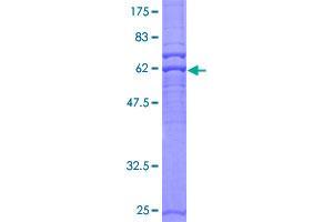 Image no. 1 for Protein Kinase, AMP-Activated, gamma 2 Non-Catalytic Subunit (PRKAG2) (AA 1-328) protein (GST tag) (ABIN1316235) (PRKAG2 Protein (AA 1-328) (GST tag))