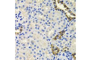 Immunohistochemistry of paraffin-embedded mouse kidney using CALB2 antibody at dilution of 1:100 (x40 lens). (Calretinin 抗体)