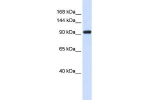 WB Suggested Anti-ZNF452 Antibody Titration:  0. (SCAND3 抗体  (N-Term))