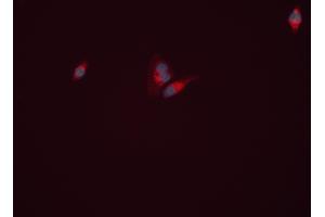 ABIN6261999 and ABIN6277813 staining HEPG2 cells by ICC/IF. (GLN1 抗体  (C-Term))