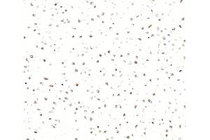 Immunocytochemistry (ICC) image for anti-Interferon, gamma-Inducible Protein 16 (IFI16) (AA 350-400) antibody (ABIN7795822)